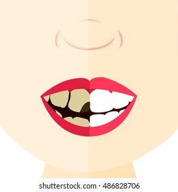 Comparison between healthy and rotten tooth. Face divided in half.