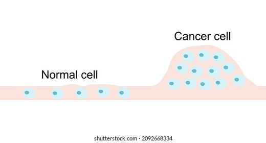 The comparison of cancer cell and normal cell in the tissue