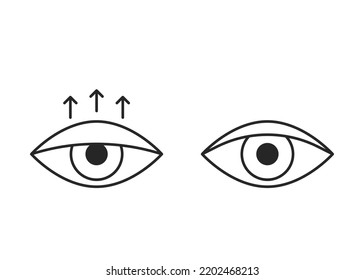 Comparar ojo con ptosis de la tapa inferior y párpado sano, icono de línea. Blefaroplastia, cirugía de párpados. Corrección estética del ojo. Ilustración del vector