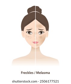 Comparison of freckles and melasma on skin woman face vector illustration isolated on white background. Types of pigmentation, Freckles, Ephelides, Solar Lentigines, Actinic lentigines and melasma.