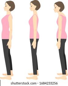 Comparison of good posture and bad posture