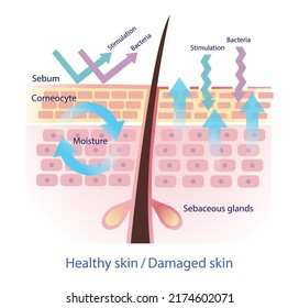 Comparison of healthy and damaged skin barrier vector on white background. The healthy sebum protect skin from stimulation and bacteria. When sebum decreased, the skin damaged. Skin care concept.