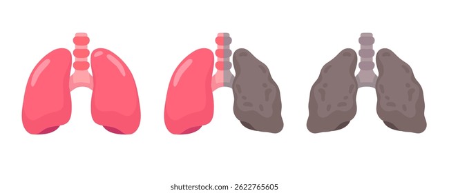 Comparison of Healthy and Diseased Lungs Illustration
