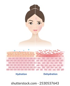 Comparação de pele saudável e seca na ilustração do vetor da face da mulher. Seção transversal da hidratação da camada de barreira cutânea, atrair, absorver água, umidade e a pele não tem água na camada superior.