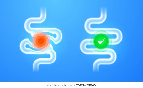 Comparación de intestino sano e inflamado. Problemas y soluciones de salud intestinal - elemento para infografías, ilustraciones médicas, educación para la salud y estudios de anatomía. Concepto gastroenterología digestiva