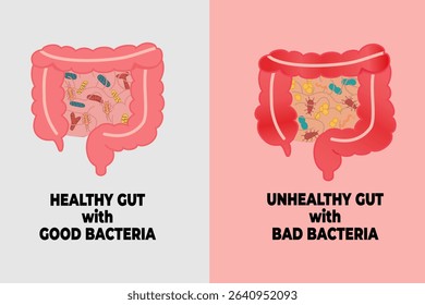 Comparison of Healthy and Unhealthy Gut with Good and Bad Bacteria