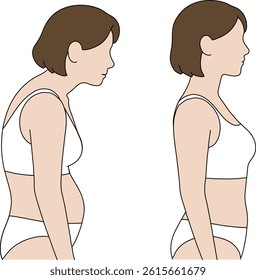 Comparison of Hunched Back and Correct Posture