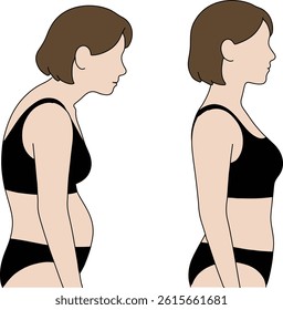 Comparison of Hunched Back and Correct Posture