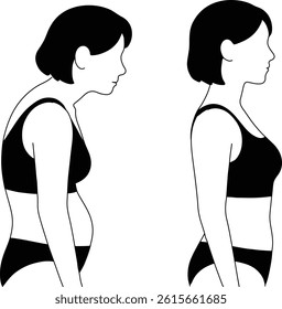 Comparison of Hunched Back and Correct Posture