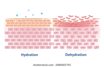 Comparison of hydration and dehydration skin vector illustration. Cross section of skin barrier layer hydration, attract, absorb water, moisture and the skin lacks water in the uppermost layer.