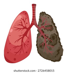 Ilustración de comparación entre un pulmón sano y un pulmón de fumador que destaca el daño causado por fumar.