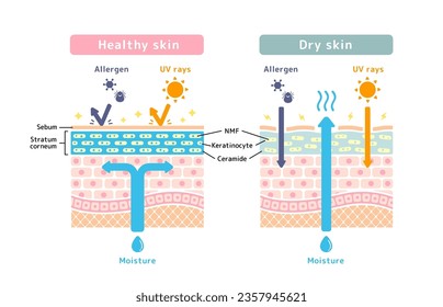 Comparison illustration of healthy skin and dry skin (cross section of skin)