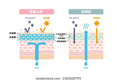 Comparison illustration of healthy skin and dry skin (cross section of skin). Translation: Dry skin, Allergen, Ultraviolet light, Sebum, Ceramide, Moisture, NMF, Corneocytes, Intercellular lipids