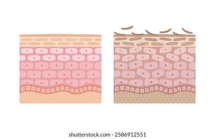 Comparison illustration of healthy skin and unhealthy skin