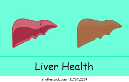 Comparison of liver with good health and diseased liver.
