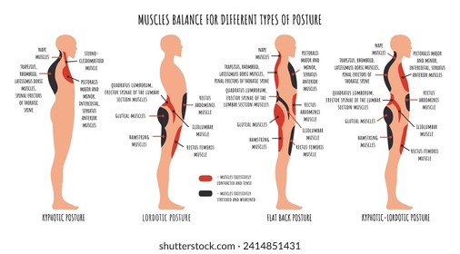 Comparison of muscle imbalance in various postural disorders. Kyphotic, lordotic, flat back posture infographics. The side view shows characteristic stretched and weakened, shortened and tens muscles