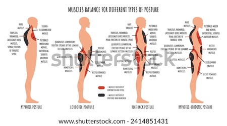 Comparison of muscle imbalance in various postural disorders. Kyphotic, lordotic, flat back posture infographics. The side view shows characteristic stretched and weakened, shortened and tens muscles [[stock_photo]] © 