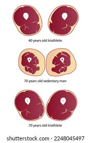 Comparison of muscle mass vector illustration isolated on white background. Cross section of muscle mass of triathlete and sedentary man in different age. Anatomy and health care concept illustration.