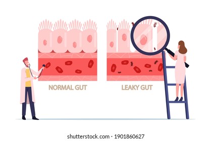 Comparison of Normal and Sick Gastrointestinal Tract Tissue, Leaky Gut Syndrome. Tiny Doctors Characters Presenting Difference Healthy and Inflamed Intestinal Cells. Cartoon People Vector Illustration