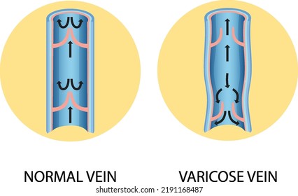 19,791 Vein drawing Stock Illustrations, Images & Vectors | Shutterstock