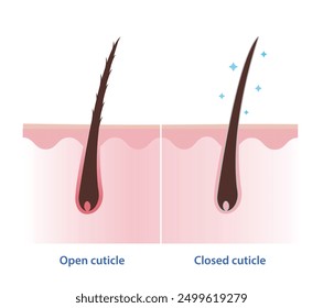 Comparison of open and closed hair cuticle on scalp layer vector illustration isolated on white background. Cross section of hair shaft without conditioner and with conditioner. Hair care concept.