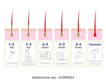 Comparison of the popular methods of hair removal: laser, epilator, waxing and shaving. Infographics