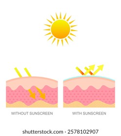 Comparison of skin using sunscreen with normal skin. Protection of the skin from ultraviolet radiation