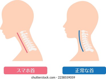 Comparison of smartphone neck and normal neck

In Japanese, it says "smartphone neck" and "normal cervical spine"