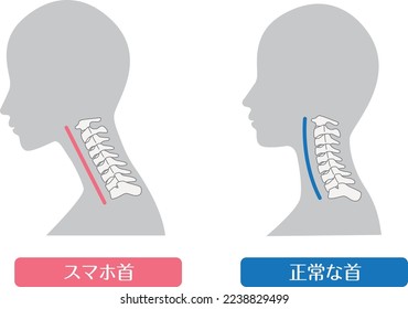 Comparison of smartphone neck and normal neck

In Japanese, it says "smartphone neck" and "normal cervical spine"