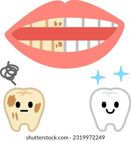 Comparison of stained and white teeth