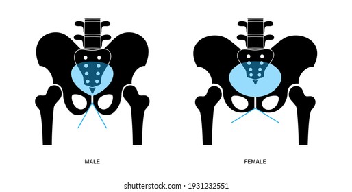 Comparison Of The Structure Of Male And Female Pelvis. Anatomical Poster Of Human Skeleton. Pelvic Bones Concept. Sacrum, Ischium, Pubis And Ilium. Coccyx And Pubic Symphysis Flat Vector Illustration.