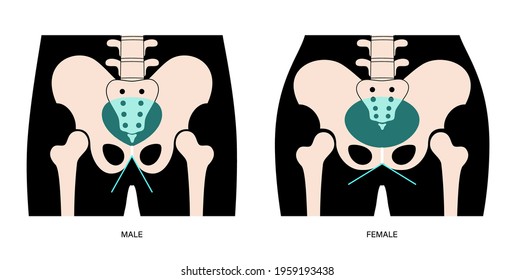 Comparison of the structure of male and female pelvis. Anatomical poster of human skeleton. Pelvic bones concept. Sacrum, Ischium, pubis and ilium. Coccyx and pubic symphysis flat vector illustration.