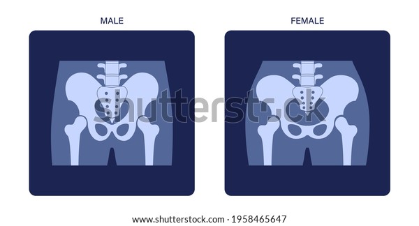 Comparison Of The Structure Of Male And Female Pelvis Anatomical