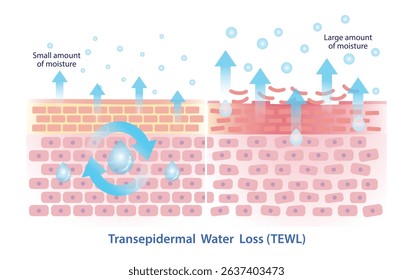 Comparison of transepidermal water loss illustration isolated on white background. Skin barrier in healthy state, TEWL small amount of moisture and damaged skin state, TEWL large amount of moisture.