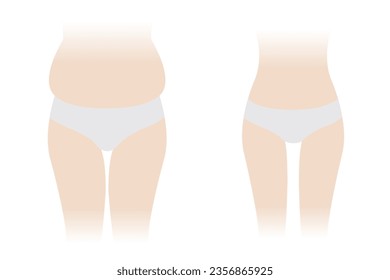 Comparison of woman body fat and slim vector isolated on white background. The woman with fat belly, hip, thigh and slender body. Slim waist compared to body fat. Before and after weight loss.