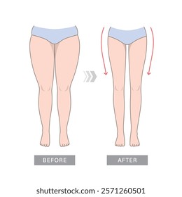 Comparison of woman body fat and slim. Cellulite weight loss procedures. Legs of standard slim size and fat legs. Illustration of before and after reducing leg size.