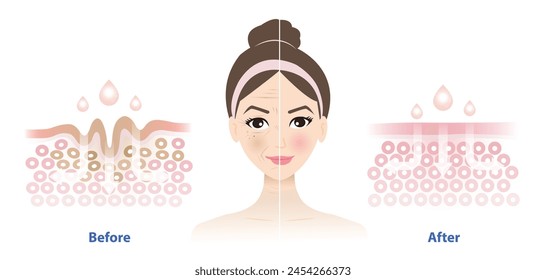 Comparison of woman face before and after skincare reduce wrinkles vector. Cross section of wrinkles skin and skincare absorbing to help reduce aging and damaged skin. Skin care and beauty concept.