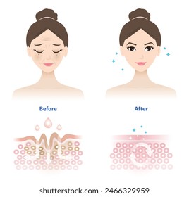 Comparison of woman face before and after wrinkle skincare absorption illustration on white background. Cross section of wrinkles skin and skincare absorbing to help reduce aging and damaged skin.