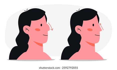 Comparison woman profile before and after rhinoplasty surgery. Female nose job plastic operation info graphic. Pre surgery and post procedure appearance. Medicine, beauty concept. Vector illustration.