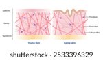 Comparison of young and aging skin vector on white background. Cross section of high and low density of collagen, elastin fibers and fibroblasts in the dermis layer. Skin care and beauty concept.