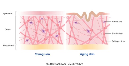 Comparison of young and aging skin vector on white background. Cross section of high and low density of collagen, elastin fibers and fibroblasts in the dermis layer. Skin care and beauty concept.