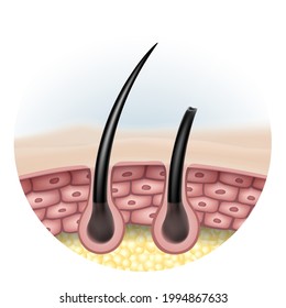 Complete comparison of hair Shine with damaged hair and split ends.
Use instead of pores showing the side images of skin cells and fat layer. EPS Realistic file.