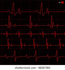 complete set of cardiograms