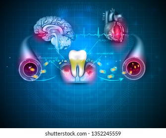 Complications of gum disease Periodontitis.  Bacteria from inflamed gums can enter in to the blood stream and affect other organs such as heart and brain. Beautiful abstract blue design poster.