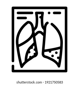 complications or pneumonia line icon vector. complications or pneumonia sign. isolated contour symbol black illustration
