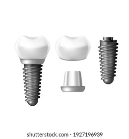 Component Parts Of Dental Implant - Teeth Denture