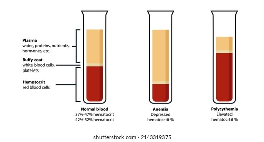 Composition Of Blood: Plasma, Buffy Coat, Hematocrit. Сorrelation Between Red Blood Cells (erythrocytes), White Blood Cells (leukocytes), Proteins, Hormones Defines Normal Blood, Anemia, Polycythemia