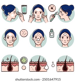 Comprehensive Guide to Acne Care
