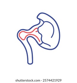 Comprehensive Illustration of Lesser Tubercle Anatomy