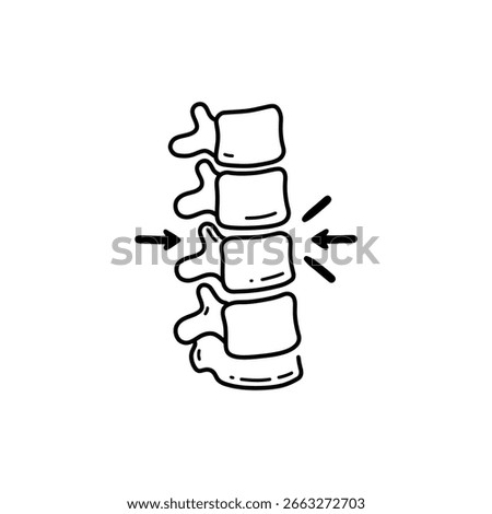 Compressed Vertebra with Arrows Indicating Spinal Compression